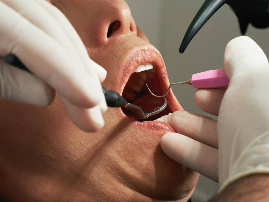 A person is getting dental tools inserted into their mouth.